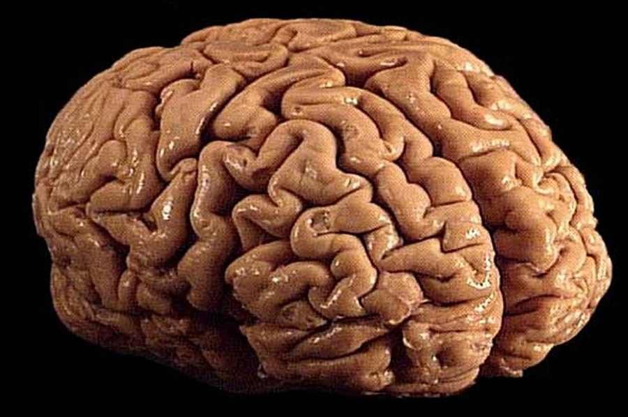 Genes responsible for the evolution of the human brain have been identified